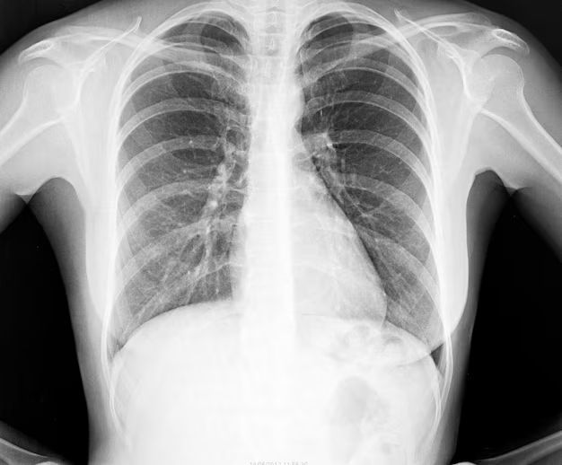 What is the most popular X-ray